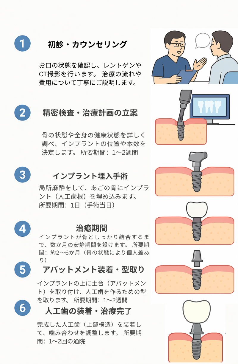 インプラント治療の流れ